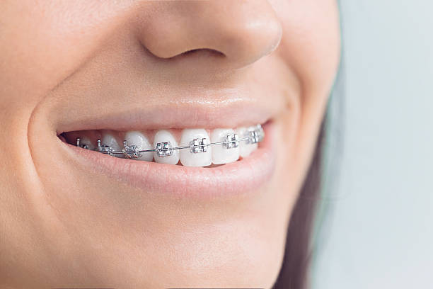 Best Dental Fillings (Composite and Amalgam)  in Greens Farms, CT